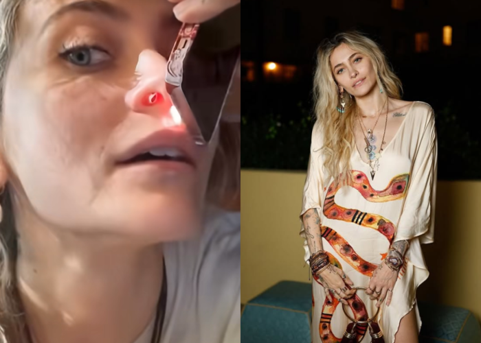 마이클 잭슨 딸인 패리스 잭슨이 공개한 마약 부작용 '비중격 천공'. 사진=패리스 잭슨 틱톡/인스타그램